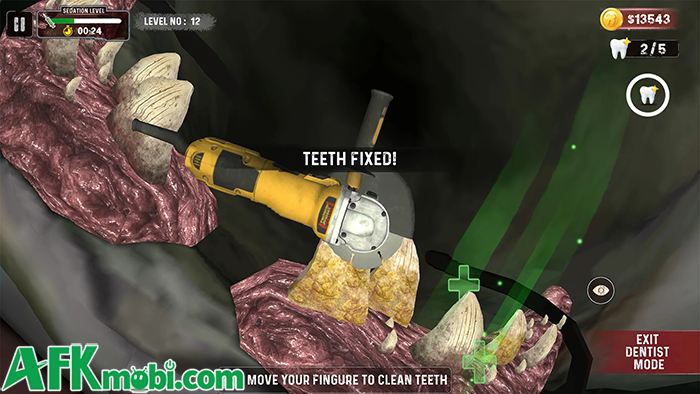 Làm nha sĩ chữa răng cho cá mập trong game mô phỏng Shark Teeth Dentist Simulator 3